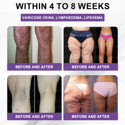 US-FDA 𝖮𝖿𝖿𝗂𝖼𝗂𝖺𝗅 𝖲𝗍𝗈𝗋𝖾 | 𝐃𝐫 𝐄𝐫𝐚® GL𝐏-1 8-𝒊𝒏-1 𝙁𝙞𝙩 & 𝙑𝙞𝙩𝙖𝙡 𝖮𝗋𝖺𝗅 𝙎𝙤𝙡𝙪𝙩𝙞𝙤𝙣  (𝑱𝒖𝒔𝒕 𝒐𝒏𝒄𝒆 𝒂 𝒅𝒂𝒚, 𝒗𝒊𝒔𝒊𝒃𝒍𝒆 𝒄𝒉𝒂𝒏𝒈𝒆𝒔 𝒊𝒏 7 𝒅𝒂𝒚𝒔) ✅ 𝑭𝒐𝒓 𝒐𝒃𝒆𝒔𝒊𝒕𝒚, 𝒄𝒂𝒓𝒅𝒊𝒐𝒗𝒂𝒔𝒄𝒖𝒍𝒂𝒓 𝒉𝒆𝒂𝒍𝒕𝒉, 𝒅𝒊𝒂𝒃𝒆𝒕𝒆𝒔, 𝒔𝒍𝒆𝒆𝒑 𝒂𝒑𝒏𝒆𝒂, 𝒈𝒖𝒕 𝒉𝒆𝒂𝒍𝒕𝒉, 𝒋𝒐𝒊𝒏𝒕 𝒊𝒔𝒔𝒖𝒆𝒔 𝒂𝒏𝒅 𝒎𝒐𝒓𝒆